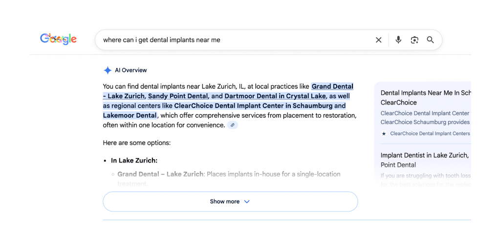 where can I get dental implants near me